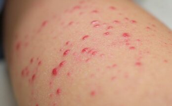 If you spot these red dots on your skin, you had better know what they mean 😮 I had no clue!